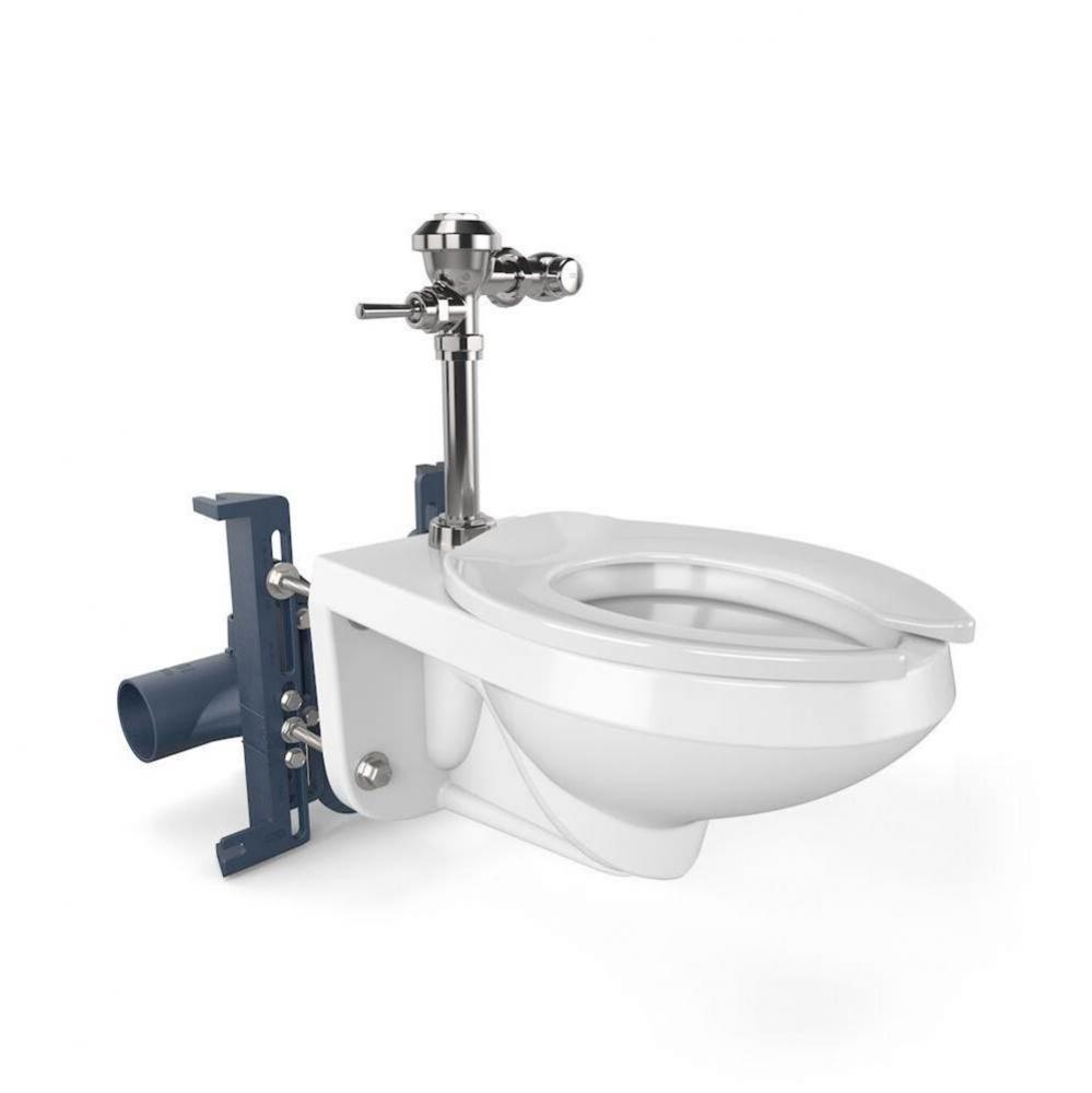 1.1 GAL EXPOSED VALVE